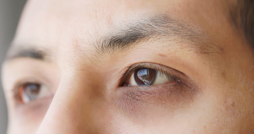 Occhiaie dormire blu