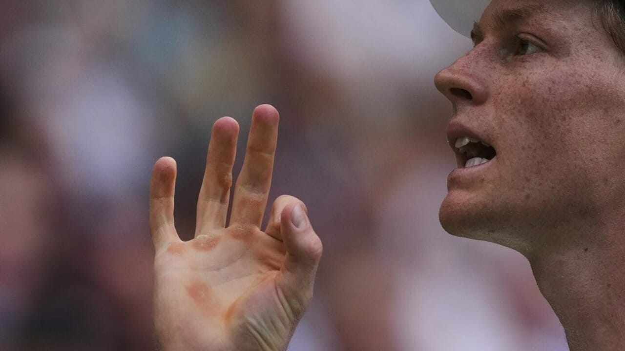 Sinner was sick and the organizers of Cincinnati whistle the ears