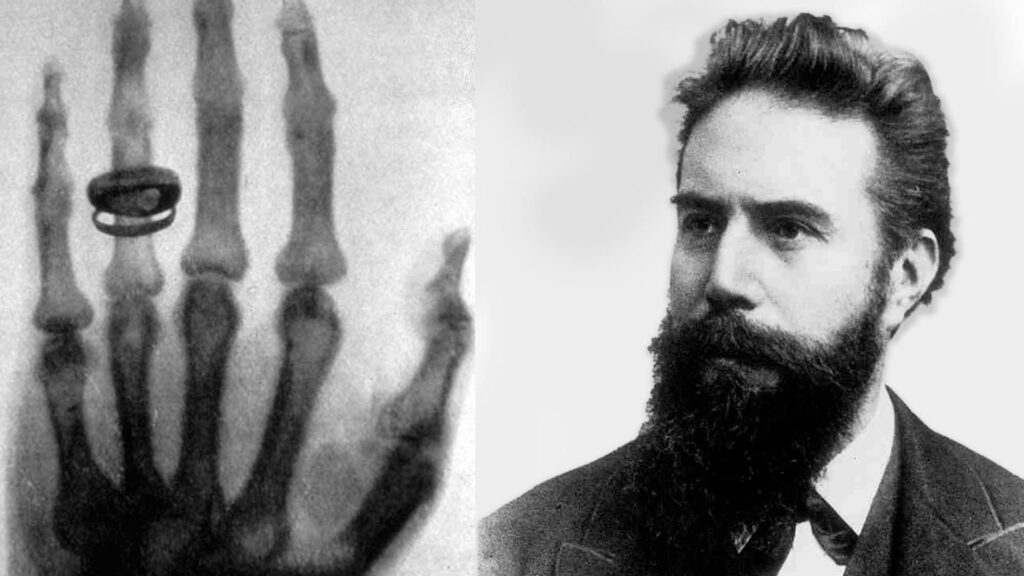 150 years ago X-rays were discovered by Wilhelm Röntgen, the man who changed science
