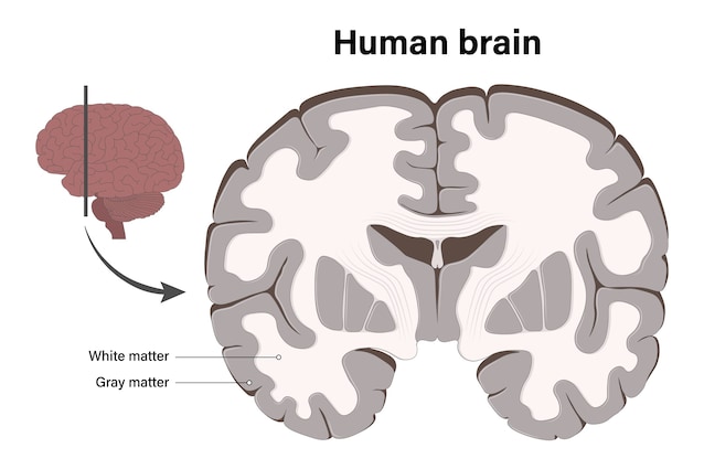 gray and white matter brain