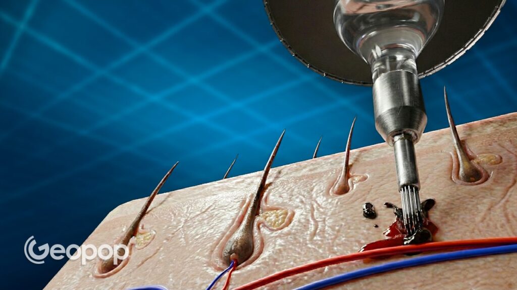 What happens to the human body with tattoos: here's how they are done