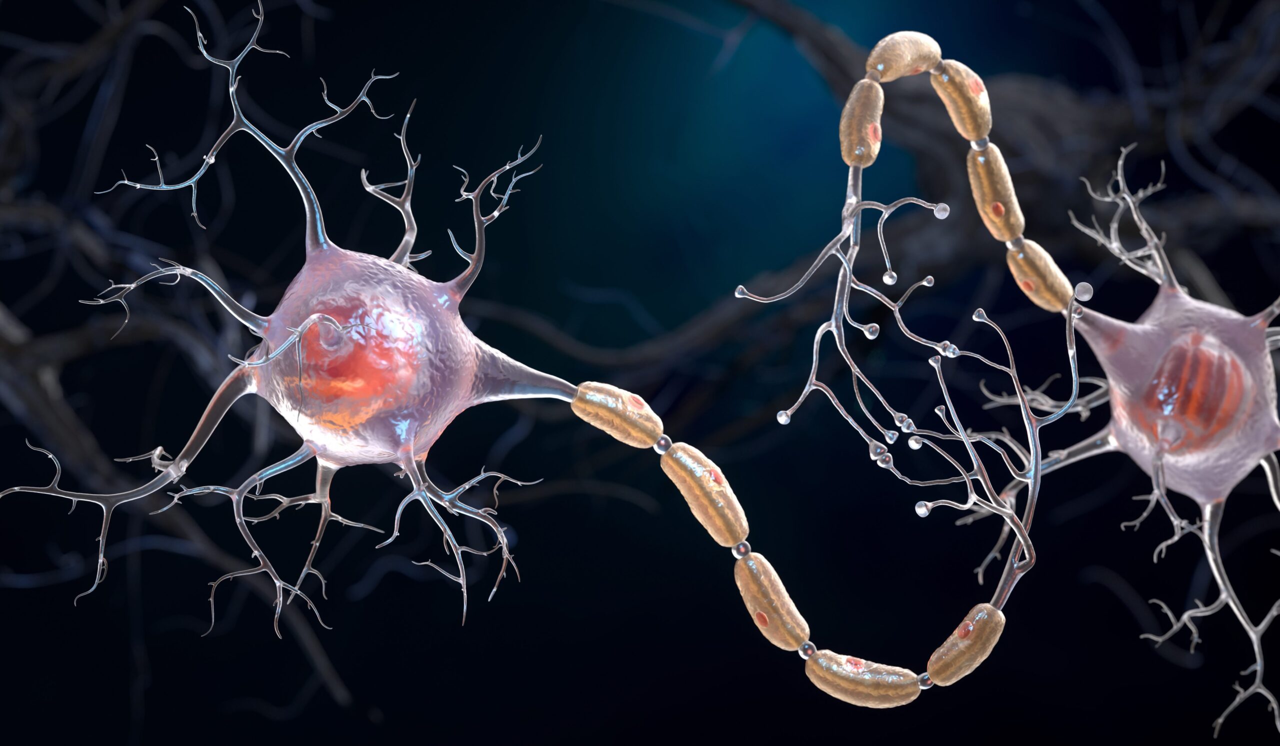 Multiple sclerosis, new clues to the underlying causes of the disease: studies on the Epstein-Barr virus