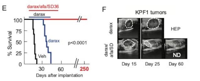 pancreas tumor study graphs