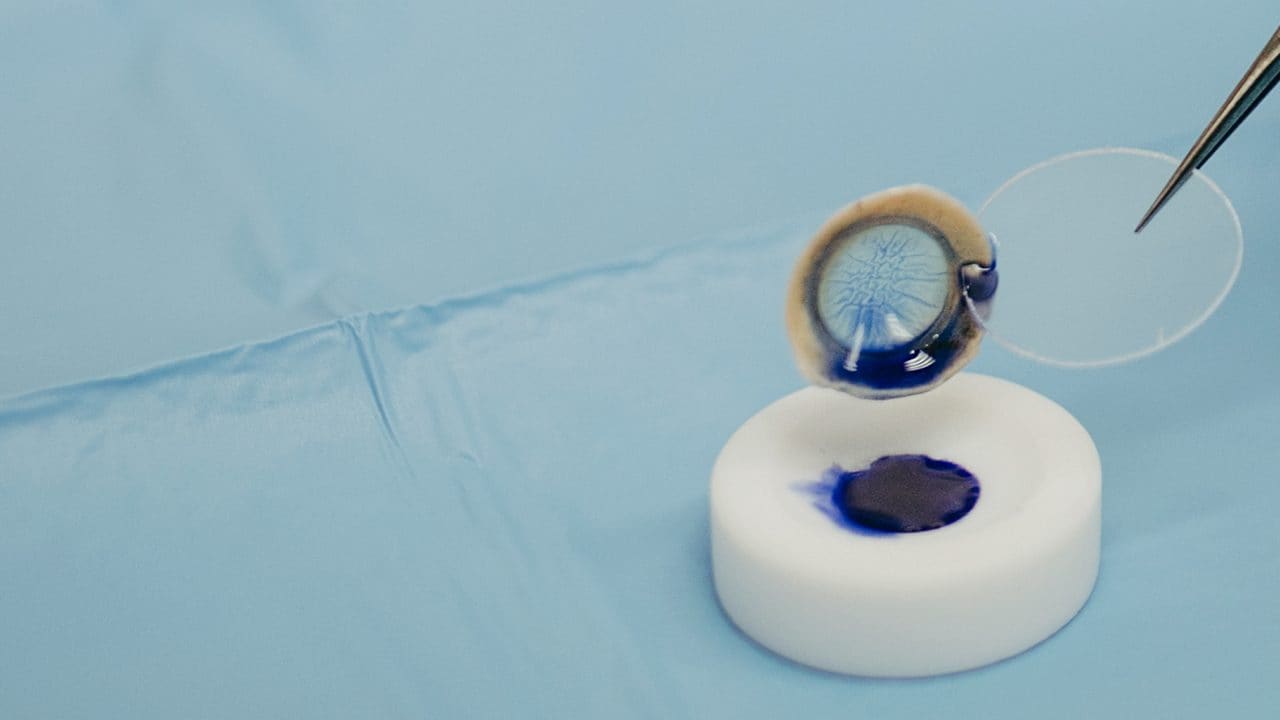 How cornea transplant works: we entered an Eye Bank
