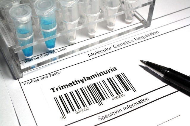 trimethylaminuria diagnosis