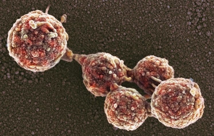 The first “zombie” bacterium brought back to life with the DNA of another species: the JCVI study