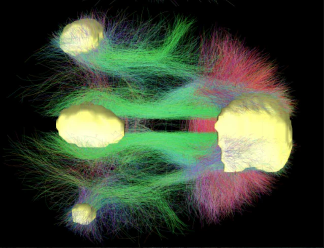 default neural network