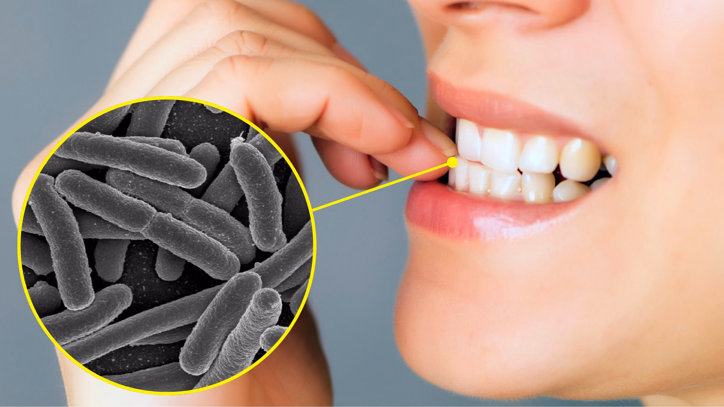 Under the nails there are up to 100 times more bacteria than in the rest of the hand: microbiology studies