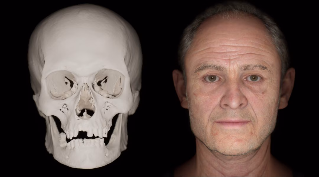 The face of the Man of the Conquest of England in 1066 revealed: was he a Viking or a Saxon?