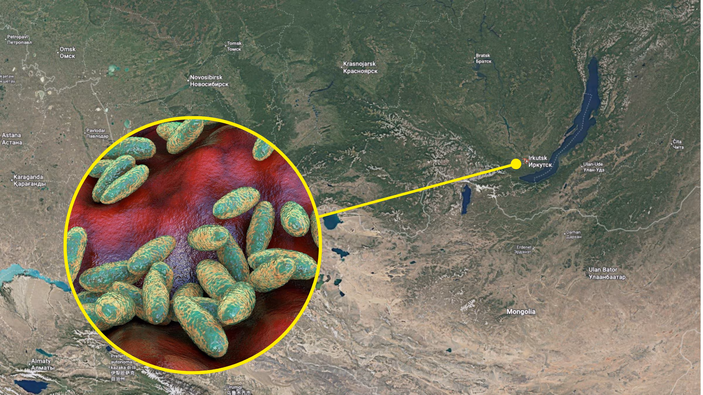 What we know about the alleged case of pneumonic plague in Siberia, where in the world it is and how the infection occurs
